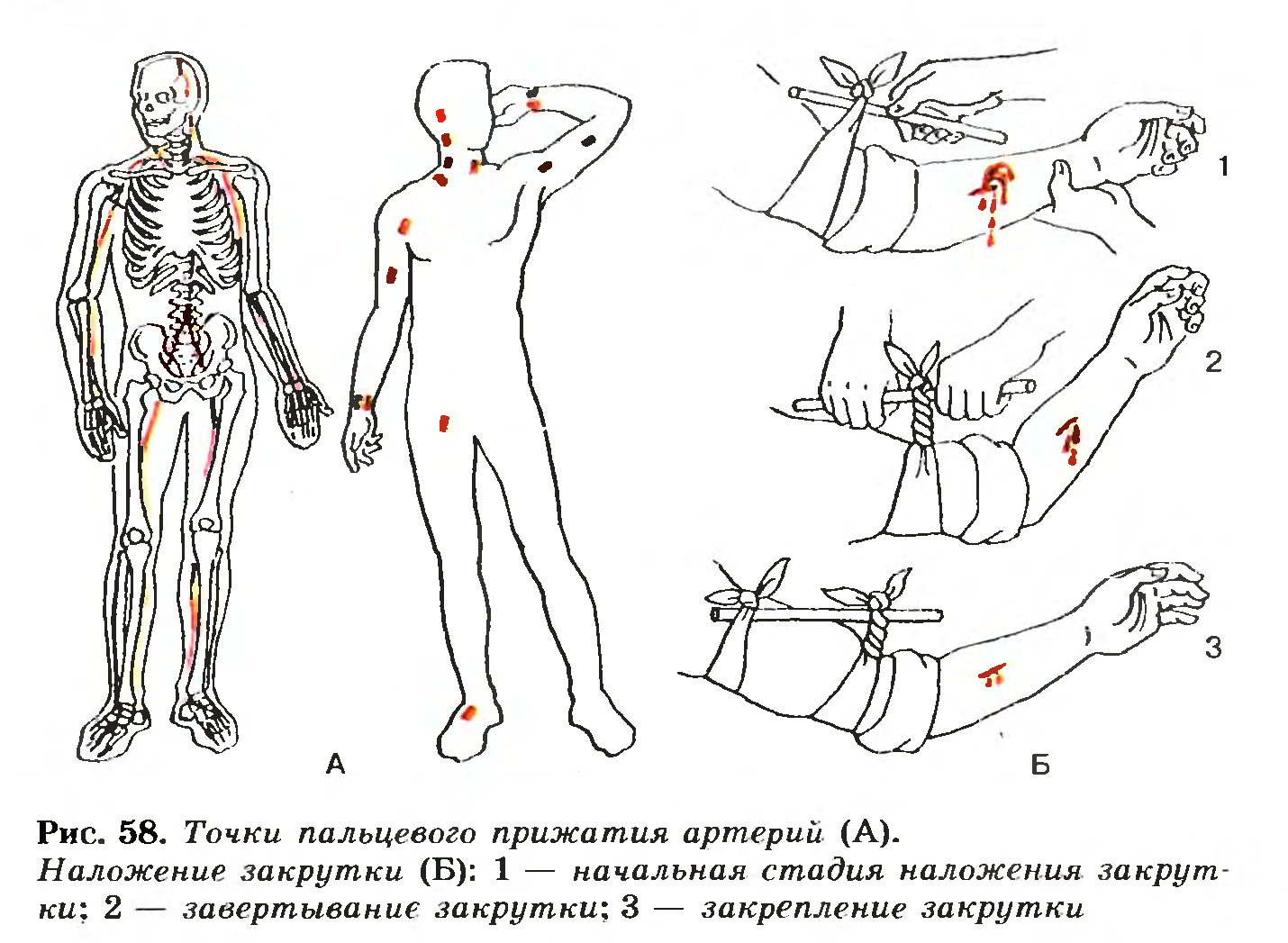 Точки пальцевого прижатия артерий
