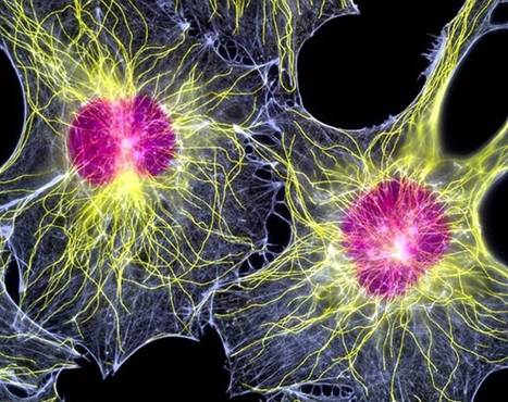 Бузковим кольором забарвлені ядра клітин