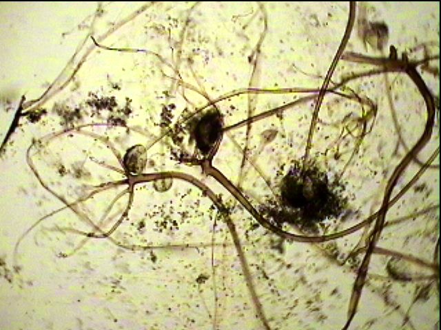 микроскопический почвенный гриб мукор