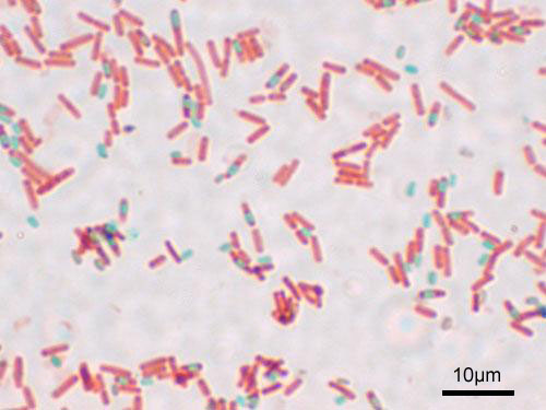 Почвенные микроорганизмов, освобождающие минеральные соединения из растительных остатков: бактерии, дрожжи.